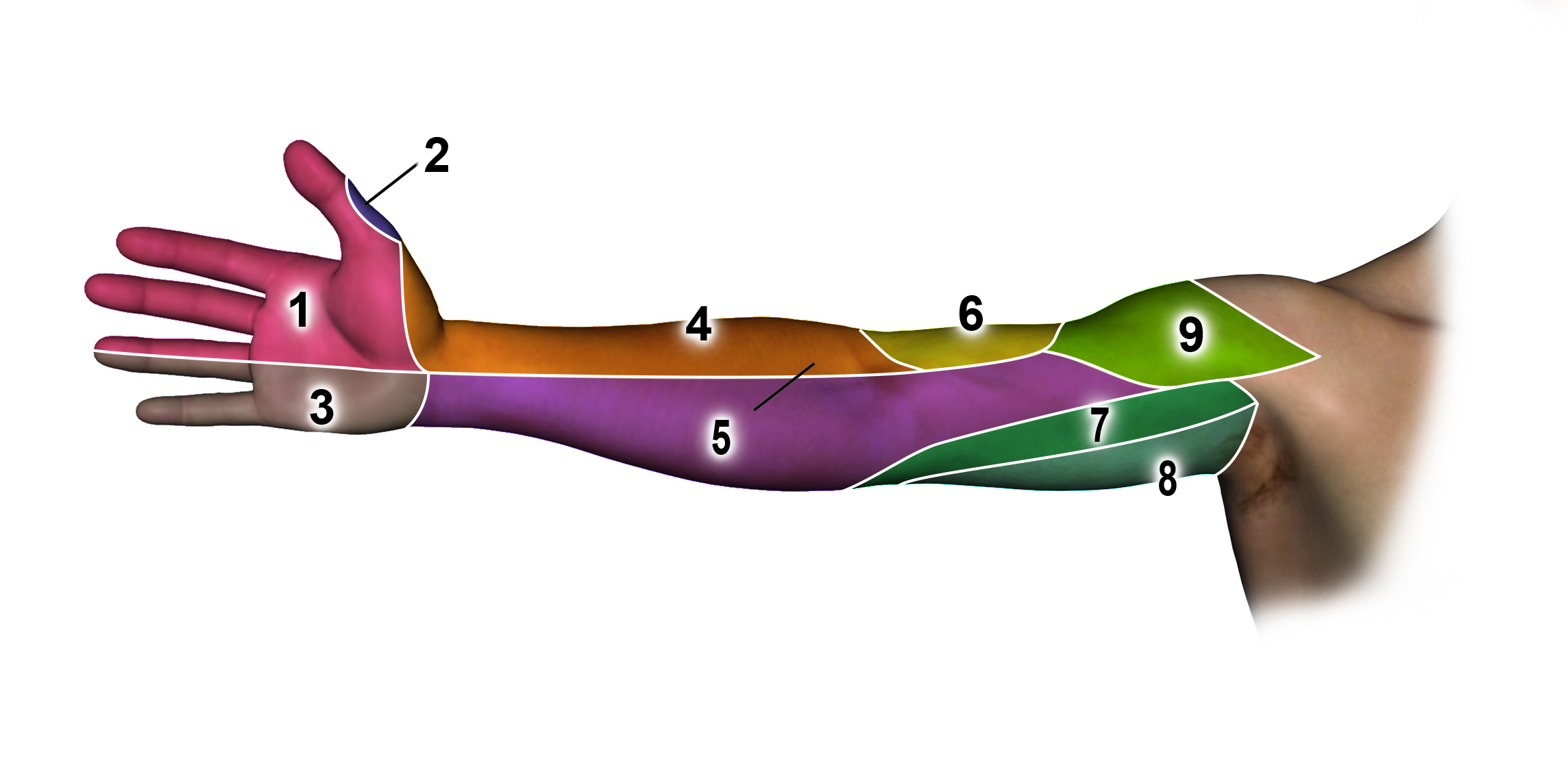 Anterior (palmar or volar ) Sensation by Nerve: 1 = median nerve; 2 = dorsal radial sensory nerve; 3 = ulnar nerve; 4 = lateral antebrachial cutaneous nerve; 5 = medial antebrachial cutaneous nerve; 6 = radial dorsal antebrachial cutaneous nerve; 7 = medial brachial cutaneous nerve; 8 = intercostobrachial nerve; 9 = axillary nerve (superior lateral brachial cutaneous nerve.