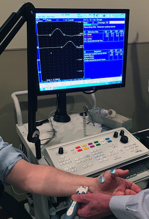 EMG/NCV investigations may help define location and magnitude of closed nerve injuries.