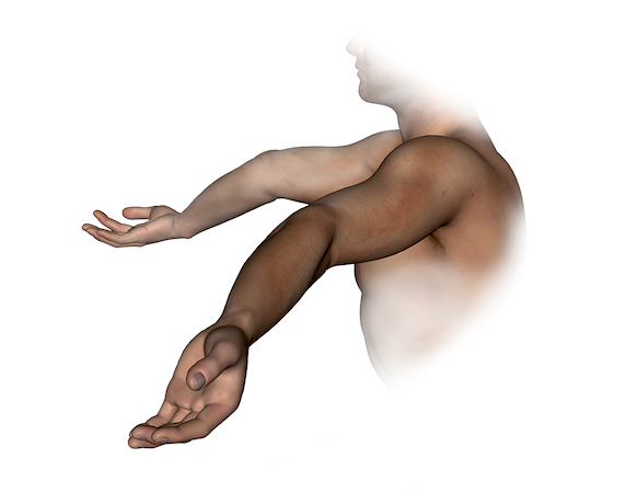 Joint hypermobility demonstrated by extreme bilateral elbow hyperextension.