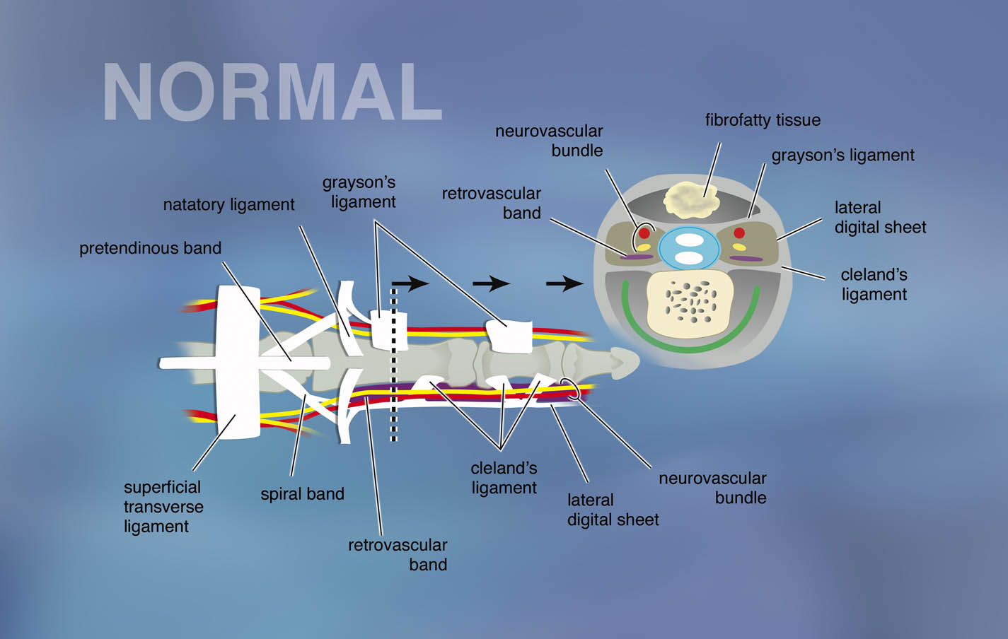 Normal Fascial structures of Distal Palm and Finger