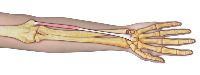 Palmaris Longus (PL) - Origin: Humerus (medial epicondyle via common flexor tendon), intermuscular septa, and deep fascia.   Insertion:  Flexor retinaculum, palmar aponeurosis, and slip sent frequently to the short thumb muscles.  Innervation: Cervical root(s): C7–8; Nerve: median nerve