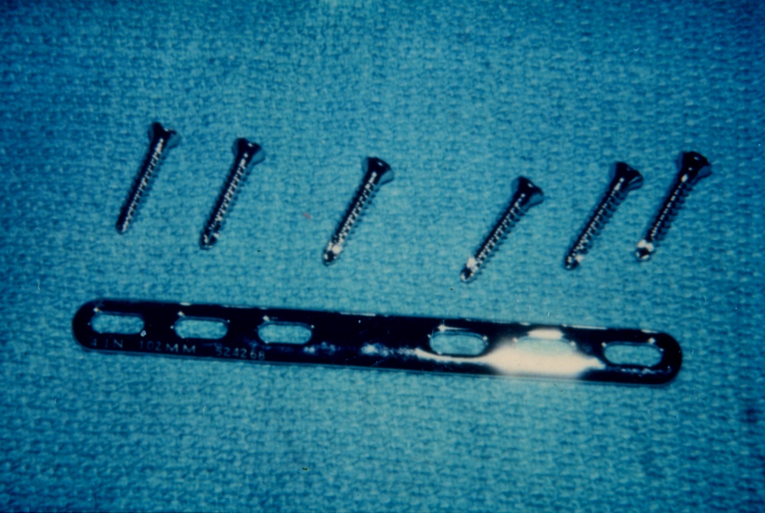 Standard 6 hole plate and self-tapping screws